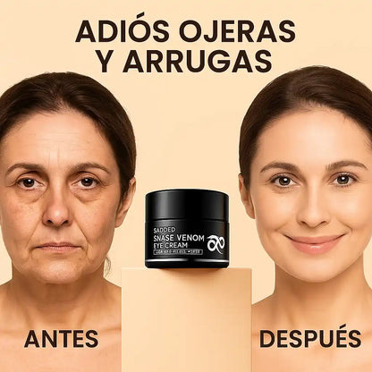SADOER Eye Cream – Reduce ojeras y tensa el contorno.